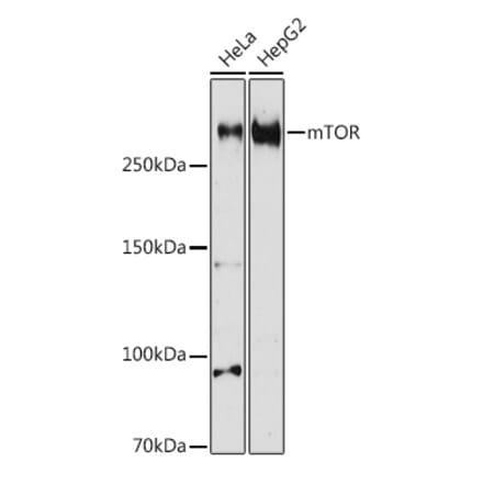 Western Blot - Anti-mTOR Antibody (A80535) - Antibodies.com