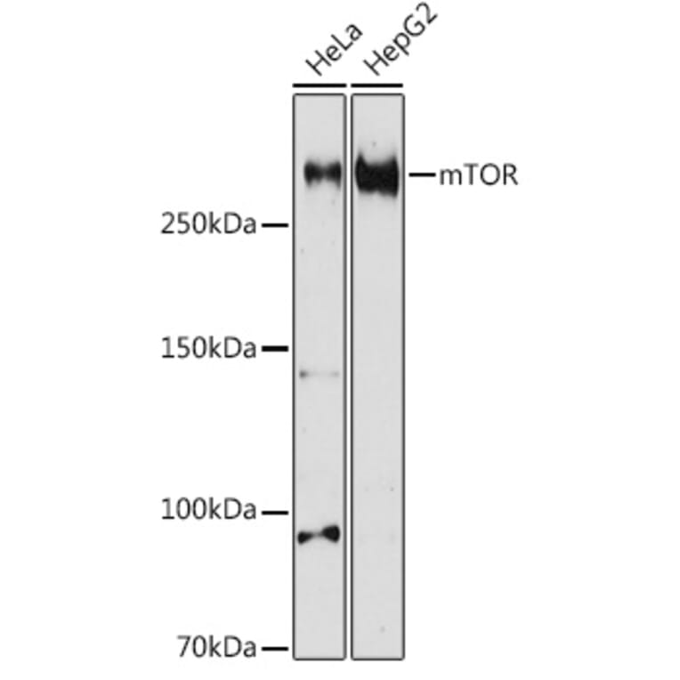Western Blot - Anti-mTOR Antibody (A80535) - Antibodies.com