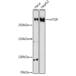 Western Blot - Anti-mTOR Antibody (A80535) - Antibodies.com