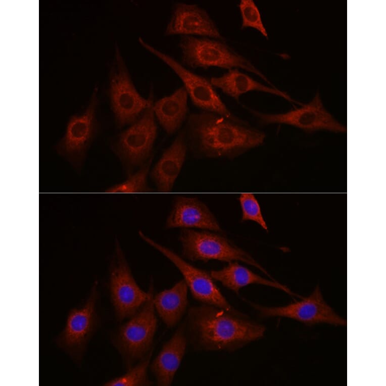 Immunofluorescence - Anti-mTOR Antibody (A80535) - Antibodies.com