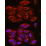 Immunofluorescence - Anti-mTOR Antibody (A80535) - Antibodies.com