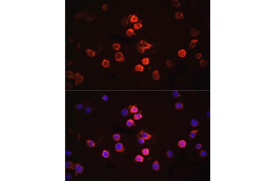 Immunofluorescence - Anti-IL-1 beta Antibody (A80536) - Antibodies.com