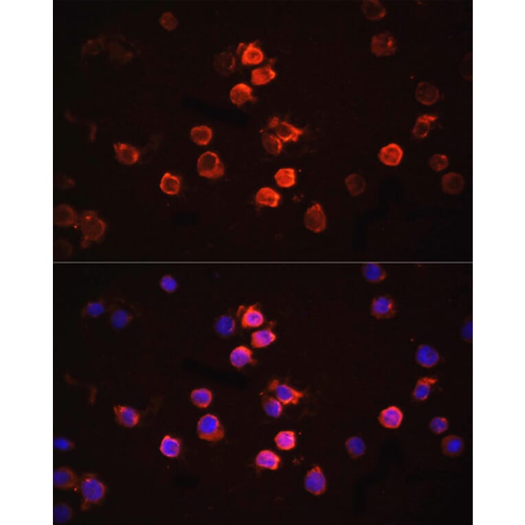 Immunofluorescence - Anti-IL-1 beta Antibody (A80536) - Antibodies.com