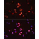 Immunofluorescence - Anti-IL-1 beta Antibody (A80536) - Antibodies.com