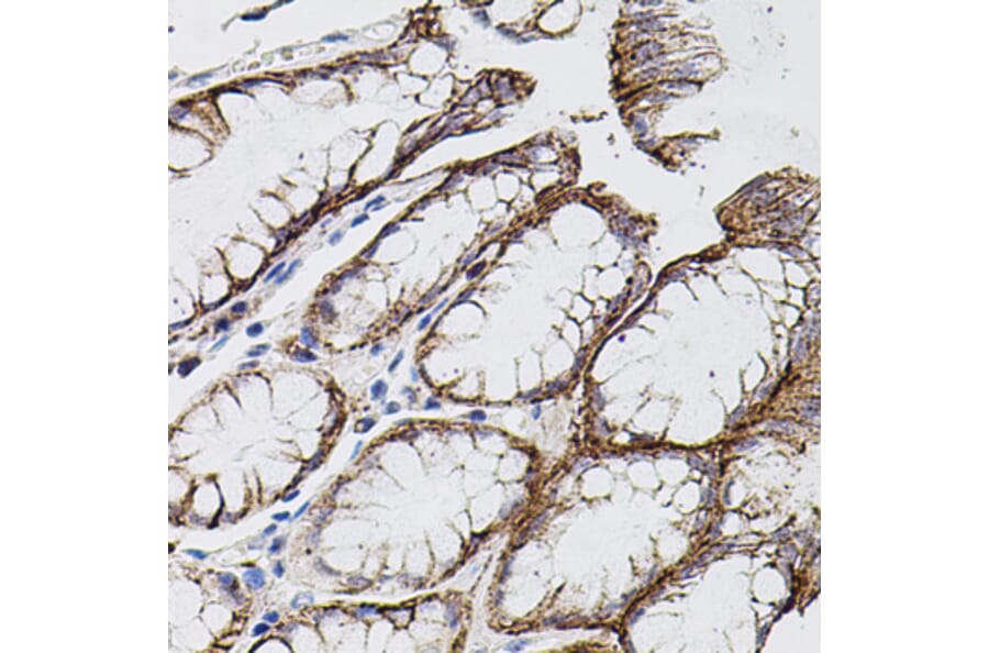 Immunohistochemistry - Anti-MMP9 Antibody (A80537) - Antibodies.com