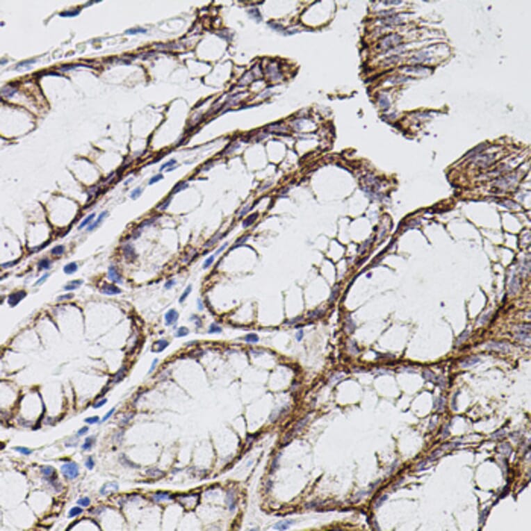 Immunohistochemistry - Anti-MMP9 Antibody (A80537) - Antibodies.com