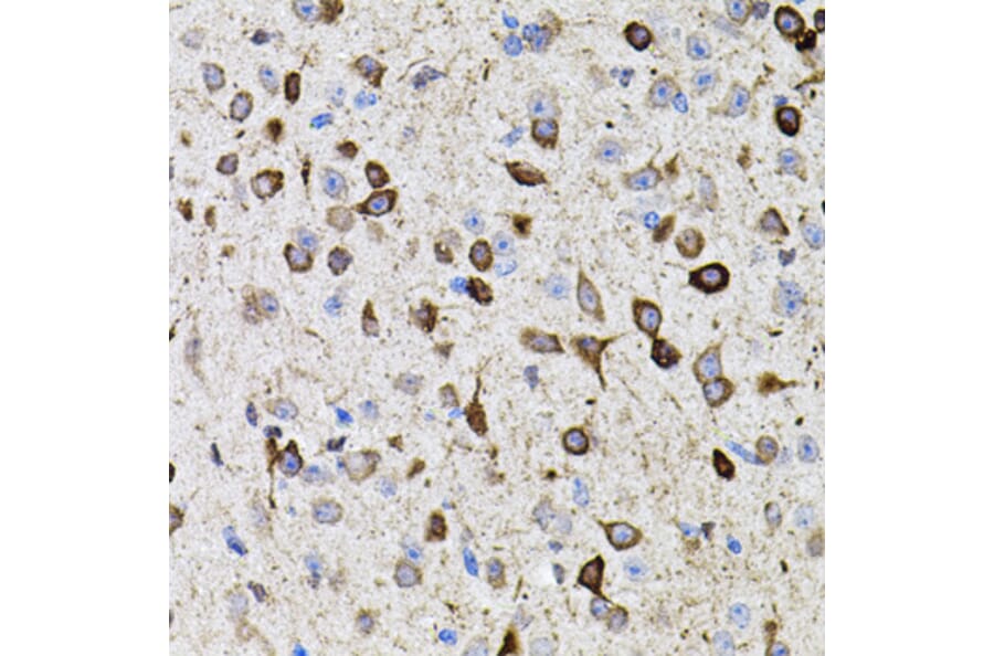 Immunohistochemistry - Anti-MMP9 Antibody (A80537) - Antibodies.com