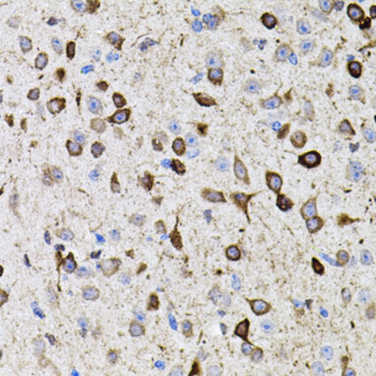 Immunohistochemistry - Anti-MMP9 Antibody (A80537) - Antibodies.com