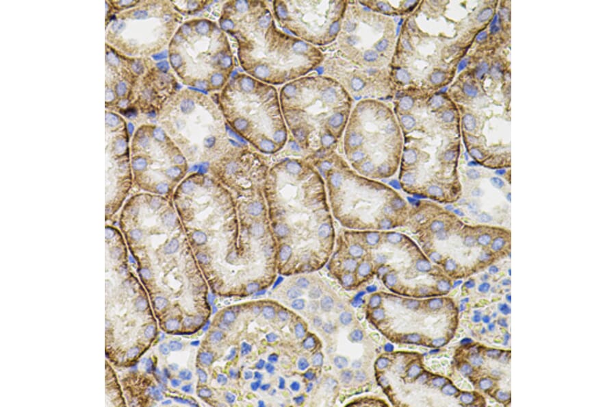 Immunohistochemistry - Anti-MMP9 Antibody (A80537) - Antibodies.com