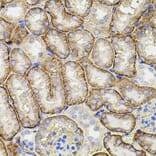 Immunohistochemistry - Anti-MMP9 Antibody (A80537) - Antibodies.com