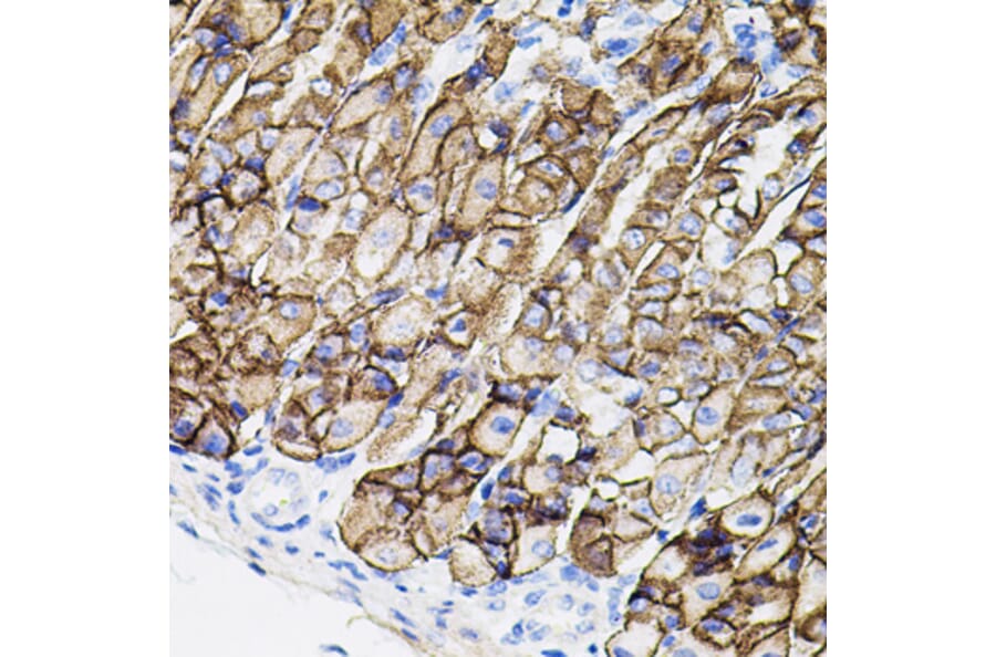 Immunohistochemistry - Anti-MMP9 Antibody (A80537) - Antibodies.com