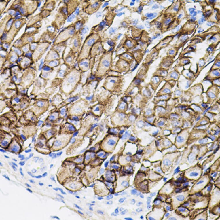 Immunohistochemistry - Anti-MMP9 Antibody (A80537) - Antibodies.com