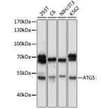 Western Blot - Anti-APG5L/ATG5 Antibody (A80538) - Antibodies.com