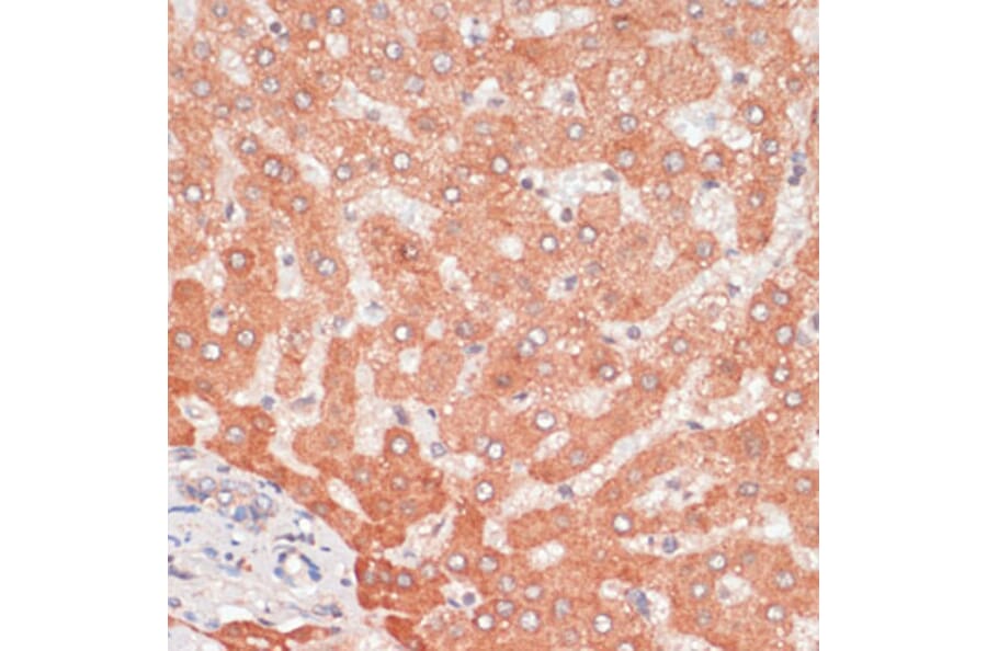 Immunohistochemistry - Anti-APG5L/ATG5 Antibody (A80538) - Antibodies.com