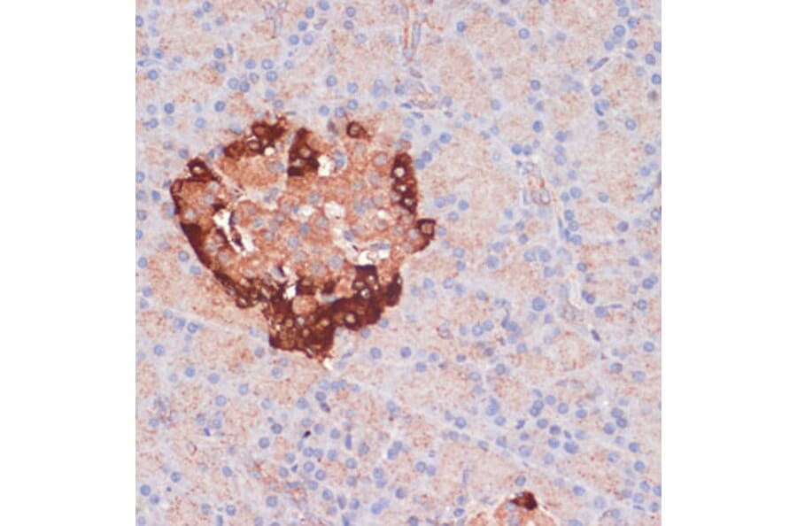 Immunohistochemistry - Anti-APG5L/ATG5 Antibody (A80538) - Antibodies.com
