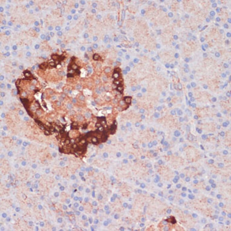 Immunohistochemistry - Anti-APG5L/ATG5 Antibody (A80538) - Antibodies.com