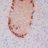 Immunohistochemistry - Anti-APG5L/ATG5 Antibody (A80538) - Antibodies.com