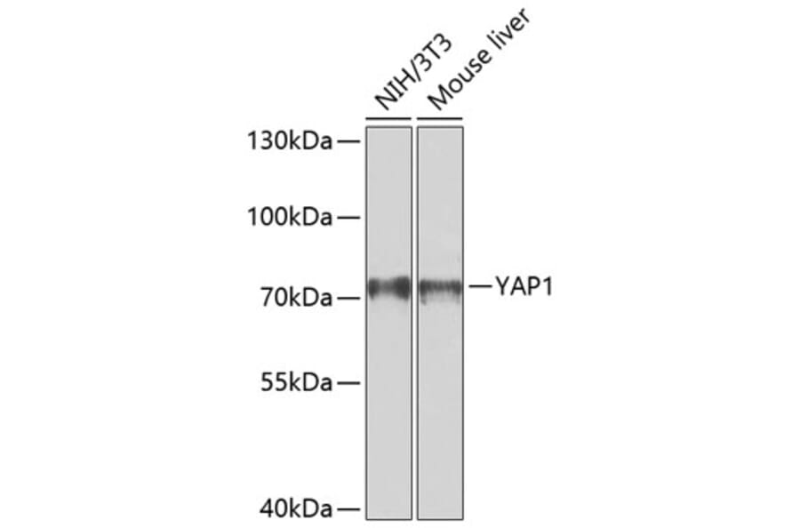 Western Blot - Anti-YAP1 Antibody (A80539) - Antibodies.com