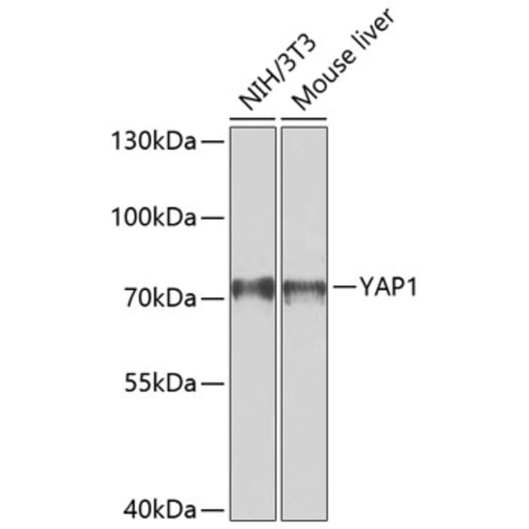 Western Blot - Anti-YAP1 Antibody (A80539) - Antibodies.com
