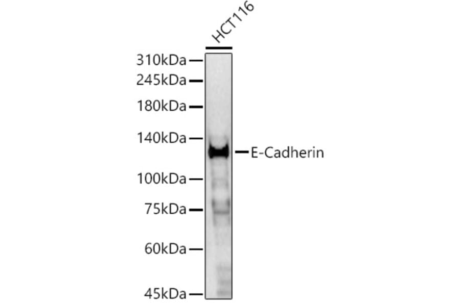 Western Blot - Anti-E Cadherin Antibody (A80540) - Antibodies.com