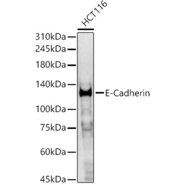 Western Blot - Anti-E Cadherin Antibody (A80540) - Antibodies.com