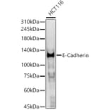 Western Blot - Anti-E Cadherin Antibody (A80540) - Antibodies.com