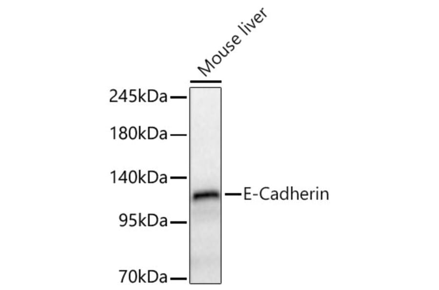 Western Blot - Anti-E Cadherin Antibody (A80540) - Antibodies.com