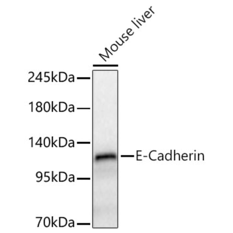 Western Blot - Anti-E Cadherin Antibody (A80540) - Antibodies.com