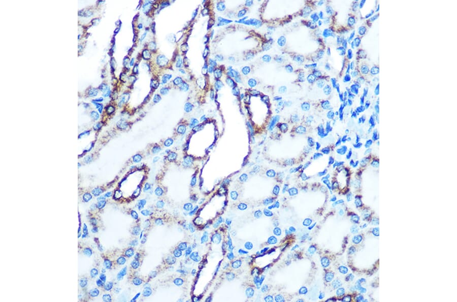 Immunohistochemistry - Anti-E Cadherin Antibody (A80540) - Antibodies.com