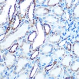 Immunohistochemistry - Anti-E Cadherin Antibody (A80540) - Antibodies.com