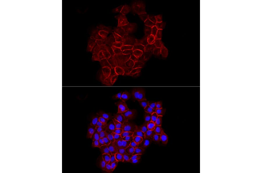 Immunofluorescence - Anti-E Cadherin Antibody (A80540) - Antibodies.com