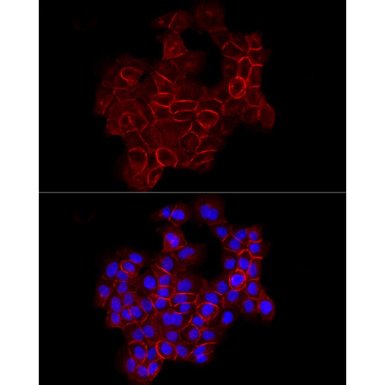 Immunofluorescence - Anti-E Cadherin Antibody (A80540) - Antibodies.com