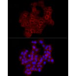 Immunofluorescence - Anti-E Cadherin Antibody (A80540) - Antibodies.com