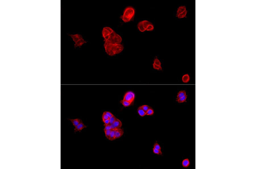 Immunofluorescence - Anti-E Cadherin Antibody (A80540) - Antibodies.com