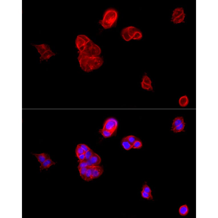 Immunofluorescence - Anti-E Cadherin Antibody (A80540) - Antibodies.com