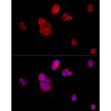 Immunofluorescence - Anti-E Cadherin Antibody (A80540) - Antibodies.com