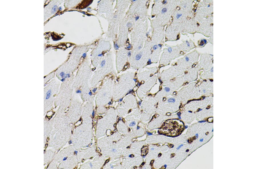 Immunohistochemistry - Anti-MMP9 Antibody (A80541) - Antibodies.com