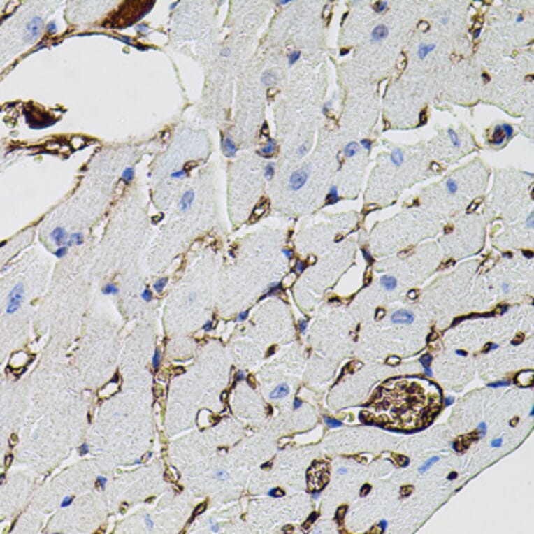 Immunohistochemistry - Anti-MMP9 Antibody (A80541) - Antibodies.com