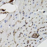 Immunohistochemistry - Anti-MMP9 Antibody (A80541) - Antibodies.com
