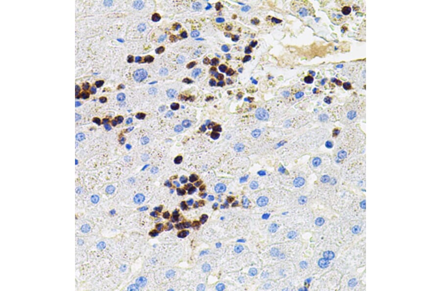 Immunohistochemistry - Anti-MMP9 Antibody (A80541) - Antibodies.com