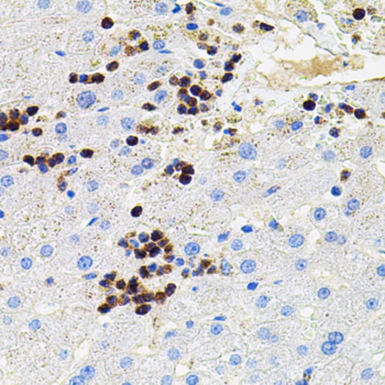 Immunohistochemistry - Anti-MMP9 Antibody (A80541) - Antibodies.com