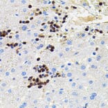 Immunohistochemistry - Anti-MMP9 Antibody (A80541) - Antibodies.com