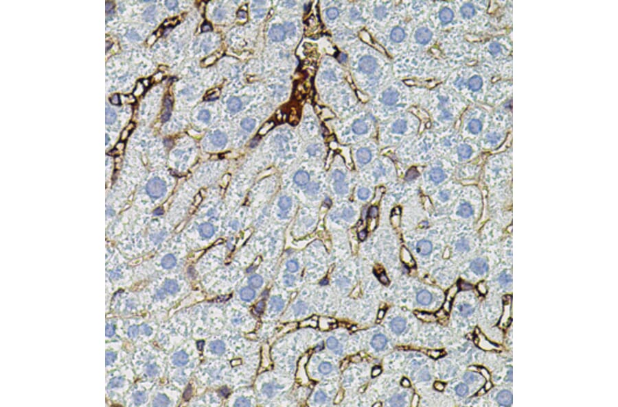Immunohistochemistry - Anti-MMP9 Antibody (A80541) - Antibodies.com