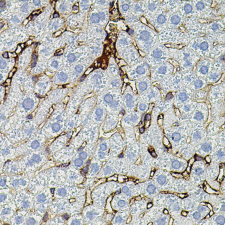 Immunohistochemistry - Anti-MMP9 Antibody (A80541) - Antibodies.com