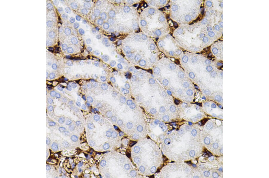 Immunohistochemistry - Anti-MMP9 Antibody (A80541) - Antibodies.com