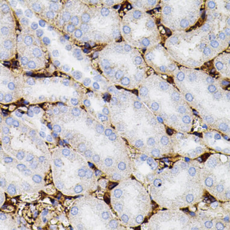 Immunohistochemistry - Anti-MMP9 Antibody (A80541) - Antibodies.com