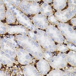 Immunohistochemistry - Anti-MMP9 Antibody (A80541) - Antibodies.com