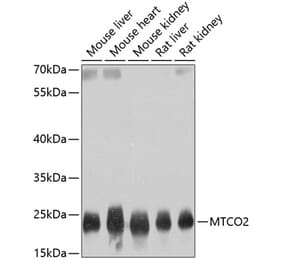 Western Blot - Anti-MTCO2 Antibody (A80542) - Antibodies.com