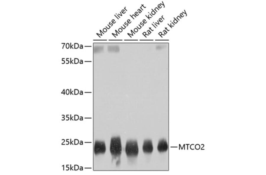 Western Blot - Anti-MTCO2 Antibody (A80542) - Antibodies.com