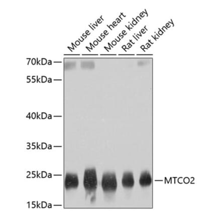Western Blot - Anti-MTCO2 Antibody (A80542) - Antibodies.com
